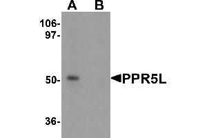 Western blot analysis of PRR5L in 3T3 cell lysate with PRR5L antibody at 1 µg/mL in (A) the absence and (B) the presence of blocking peptide (PRR5L anticorps  (Middle Region))