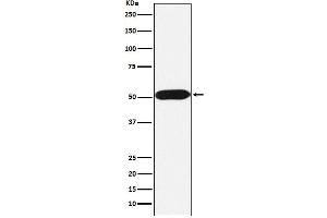 Western blot analysis of FKBP38 expression in Jurkat cell lysate.