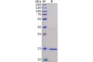 Human TNFα Protein, His Tag on SDS-PAGE under reducing condition. (TNF alpha Protein (His tag))