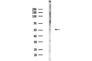anti-Calcium/calmodulin-Dependent Protein Kinase II delta (CAMK2D) (C-Term) antibody
