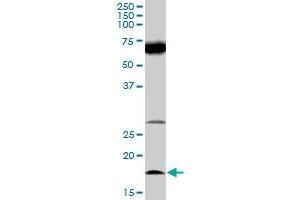IL21 MaxPab rabbit polyclonal antibody. (IL-21 anticorps  (AA 1-162))