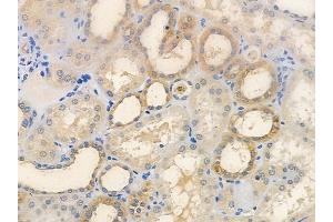ABIN6259360 and ABIN6276078 at 1/100 staining human normal kidney tissue by IHC-P.