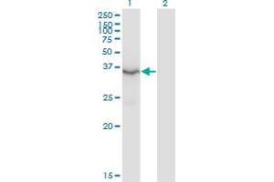 Western Blot analysis of HSD3B2 expression in transfected 293T cell line by HSD3B2 monoclonal antibody (M02), clone 1E8.