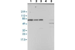Western blot analysis of Lane 1: RT-4, Lane 2: EFO-21, Lane 3: A-431, Lane 4: Liver, Lane 5: Tonsil with RBM39 polyclonal antibody  at 1:100-1:250 dilution. (RBM39 anticorps)