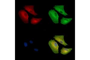 ABIN7096925 and ABIN7100991 staining  cells by IF/ICC. (CLN8 anticorps)