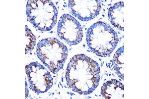 Immunohistochemistry of paraffin-embedded Human colon using CYP11 Rabbit pAb (713) at dilution of 1:100 (40x lens).