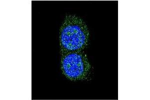 Confocal immunofluorescent analysis of SQSTM1 Antibody  with Hela cell followed by Alexa Fluor®488-conjugated Goat anti-Rabbit lgG (green).