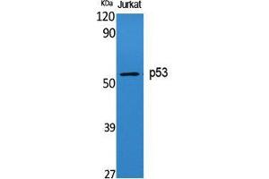 Western Blot (WB) analysis of specific cells using p53 Polyclonal Antibody.
