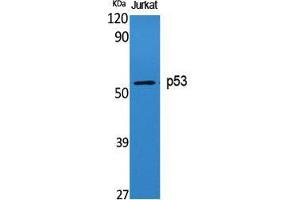 Western Blot (WB) analysis of specific cells using p53 Polyclonal Antibody. (p53 anticorps  (Tyr191))