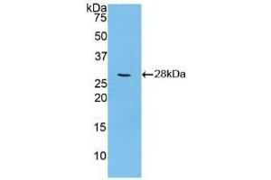 Detection of Recombinant CCND2, Human using Polyclonal Antibody to Cyclin D2 (CCND2) (Cyclin D2 anticorps  (AA 68-278))