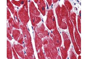 IHC Information: Paraffin embedded heart tissue, tested with an antibody dilution of 5 ug/ml. (STAU1/Staufen anticorps  (N-Term))
