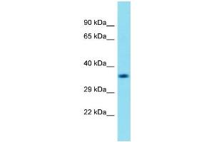 Western Blotting (WB) image for anti-Chromosome 18 Open Reading Frame 8 (C18orf8) (N-Term) antibody (ABIN2791085) (C18orf8 anticorps  (N-Term))
