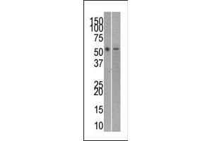 The anti-RUVBL21 Pab (ABIN388628 and ABIN2837871) is used in Western blot to detect RUVBL2 in mouse kidney (left) and SK-Br-3 (right) tissue/cell line lysates. (Reptin,TIP49B,RUVB2 (AA 400-430), (C-Term) anticorps)