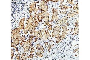 IHC analysis of GLI2 using anti-GLI2 antibody (ABIN6719569).