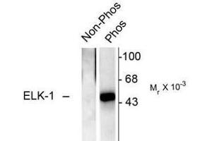 Image no. 2 for anti-ELK1, Member of ETS Oncogene Family (ELK1) (pSer383) antibody (ABIN221173) (ELK1 anticorps  (pSer383))