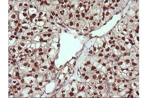 Image no. 4 for anti-Tripartite Motif Containing 38 (TRIM38) (AA 1-265) antibody (ABIN1490681) (TRIM38 anticorps  (AA 1-265))