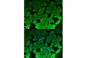 Immunofluorescence (IF) image for anti-Eukaryotic Elongation Factor-2 Kinase (EEF2K) antibody (ABIN1876592) (EEF2K anticorps)