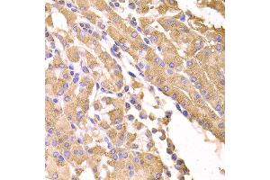 Immunohistochemistry of paraffin-embedded human stomach using SUFU antibody at dilution of 1:100 (x400 lens). (SUFUH anticorps)