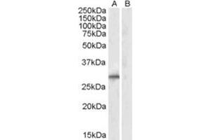 Image no. 1 for anti-E3 Ubiquitin-Protein Ligase SIAH1 (SIAH1) (N-Term) antibody (ABIN374155) (SIAH1 anticorps  (N-Term))