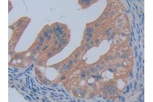 Detection of PFKP in Mouse Ovary Tissue using Polyclonal Antibody to Phosphofructokinase, Platelet (PFKP) (PFKP anticorps  (AA 247-473))