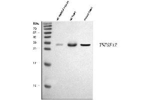 Western blot analysis of TWEAK/Tnfsf12 using anti-TWEAK/Tnfsf12 antibody (ABIN7601795).