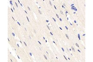 Immunohistochemistry analysis of paraffin-embedded rat heart using HES2 Polyclonal Antibody at dilution of 1:200.