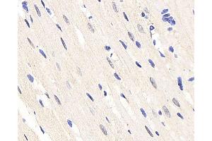 Immunohistochemistry analysis of paraffin-embedded rat heart using HES2 Polyclonal Antibody at dilution of 1:200.