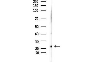 anti-Linker For Activation of T Cells (LAT) (C-Term) antibody
