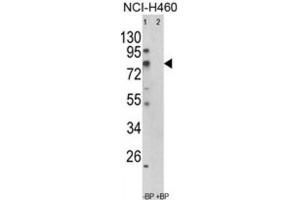 Western Blotting (WB) image for anti-Acyl-CoA Synthetase Short-Chain Family Member 3 (ACSS3) antibody (ABIN3003813) (ACSS3 anticorps)