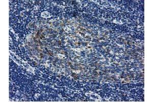 Immunohistochemical staining of paraffin-embedded Human lymph node tissue using anti-LIN7B mouse monoclonal antibody. (LIN7B anticorps)