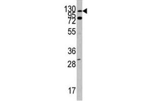 Western blot analysis of ABL1 antibody and Y79 lysate.