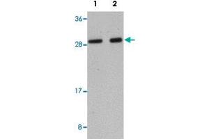 Western blot analysis of human liver tissue with LYRM1 polyclonal antibody  at (Lane 1) 1 and (Lane 2) 2 ug/mL dilution. (LYRM1 anticorps  (Internal Region))