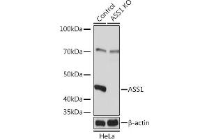 Western blot analysis of extracts from normal (control) and  Rabbit pAb knockout (KO) HeLa cells, using  Rabbit pAb antibody (ABIN7265667) at 1:3000 dilution. (ASS1 anticorps  (AA 1-412))