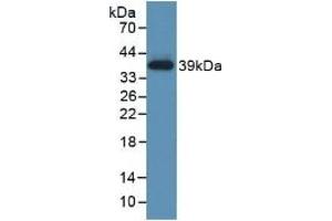 Detection of Recombinant TBG, Human using Polyclonal Antibody to Thyroxine Binding Globulin (TBG)