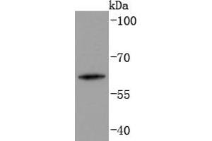 Human skin lysates probed with Cytokeratin 2e (2F7) Monoclonal Antibody  at 1:1000 overnight at 4˚C. (Keratin 2 anticorps)