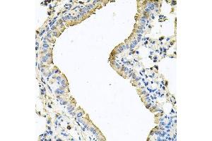Immunohistochemistry of paraffin-embedded mouse lung using CHCHD3 antibody.