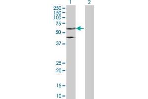Western Blot analysis of TFE3 expression in transfected 293T cell line by TFE3 MaxPab polyclonal antibody. (TFE3 anticorps  (AA 1-575))