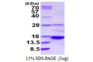 Image no. 1 for A Kinase (PRKA) Anchor Protein 7 (AKAP7) (AA 1-81) protein (His tag) (ABIN1098273)