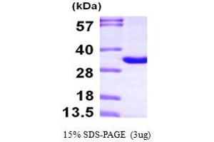 SDS-PAGE (SDS) image for Thymocyte Nuclear Protein 1 (THYN1) (AA 1-225) protein (His tag) (ABIN667247) (THYN1 Protein (AA 1-225) (His tag))