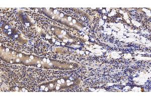 Detection of IFNb in Human Small intestine Tissue using Monoclonal Antibody to Interferon Beta (IFNb)