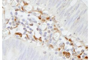 Immunohistochemistry (IHC) image for anti-Filamin A, alpha (FLNA) (AA 1725-1775) antibody (ABIN7448965)