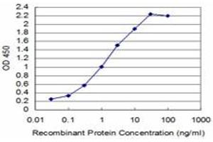 Detection limit for recombinant GST tagged T is approximately 0. (T Brachyury Protein (AA 222-320) anticorps)