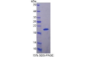 SDS-PAGE analysis of Rat Slit Homolog 2 Protein. (SLIT2 Protéine)