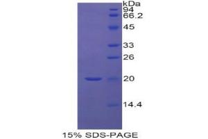 SDS-PAGE (SDS) image for Retinol Binding Protein 5, Cellular (RBP5) (AA 2-135) protein (His tag) (ABIN1878180) (Retinol Binding Protein 5 Protein (AA 2-135) (His tag))