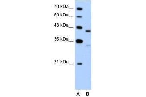 GPR161 antibody used at 5 ug/ml to detect target protein. (GPR161 anticorps  (C-Term))