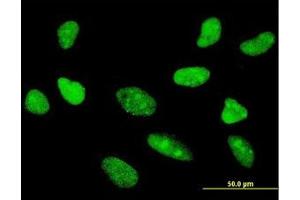 Image no. 2 for anti-Transcription Factor 7 (T-Cell Specific, HMG-Box) (TCF7) (AA 287-385) antibody (ABIN598962) (TCF7 anticorps  (AA 287-385))