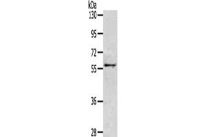 Gel: 6 % SDS-PAGE, Lysate: 40 μg, Lane: Mouse intestines tissue, Primary antibody: ABIN7130495(OLFM3 Antibody) at dilution 1/200, Secondary antibody: Goat anti rabbit IgG at 1/8000 dilution, Exposure time: 2 minutes