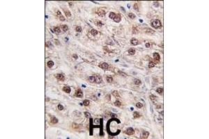 anti-Jumonji Domain Containing 4 (JMJD4) (AA 423-455), (C-Term) antibody