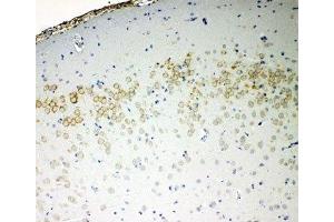 IHC-P: VE-Cadherin antibody testing of rat brain tissue (Cadherin 5 anticorps  (AA 766-784))
