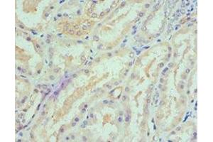 Immunohistochemistry of paraffin-embedded human kidney tissue using ABIN7168895 at dilution of 1:100 (SPTLC1 anticorps  (AA 37-310))